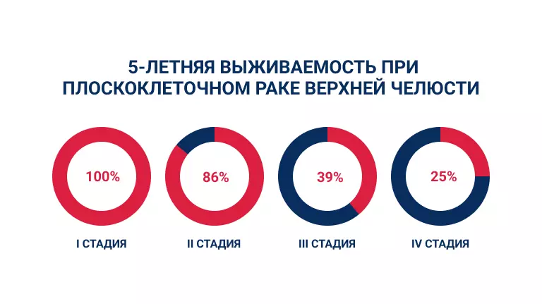 5-летняя выживаемость при плоскоклеточном раке верхней челюсти